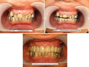 Centrage des milieux rau1cj - Eugenol