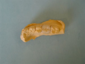 Cerec9 n84lxi - Eugenol