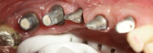 Cinq racines ruldsy - Eugenol