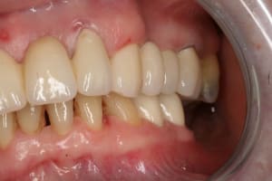 Cl2 fin2 osbsl9 - Eugenol