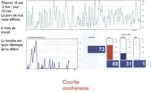 Cohérence1 jx5hla - Eugenol