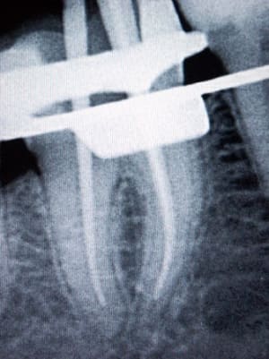 Coneenplacebio47 vvjdhg - Eugenol