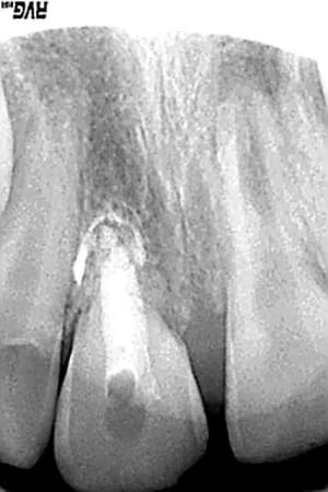 Controle 11 aout 07 owg55n - Eugenol