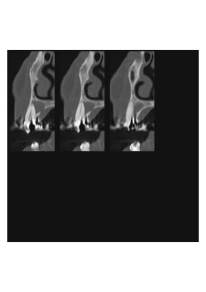 Coupe sag23 xgstya - Eugenol