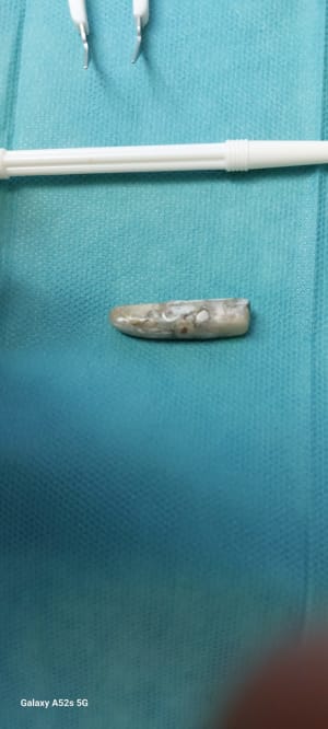 Cu7w7295djv8yezarba8jupxv7f6 - Eugenol