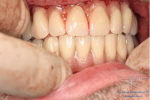 Déoulé d une mci dr r - Eugenol