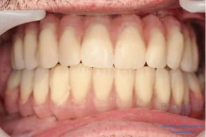 Déoulé d une mci dr r - Eugenol