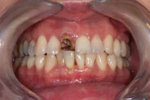 D pose compo vv5rzr - Eugenol