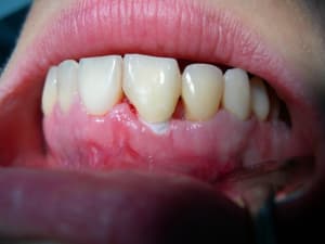 Dent mise en forme rjryex - Eugenol