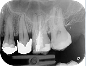 Dentisterie irl rx3fmm - Eugenol