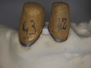 Detail or galvano sur cr primaires nf601z - Eugenol