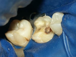 Digue rxadgf - Eugenol