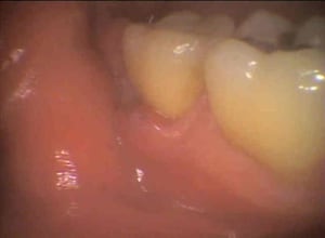 Dion2 azhvt5 - Eugenol
