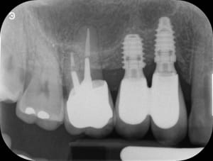 Dl5bnzknvvxvlmw2ufte1sqdph79 - Eugenol