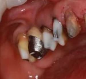 Dr le de pilier.. - Eugenol