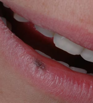 Dsc 0610 s6s5cm - Eugenol