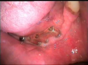 Echec1 sduay6 - Eugenol