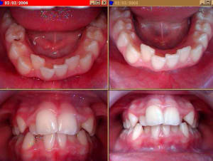Echec sb dxjrp1 - Eugenol