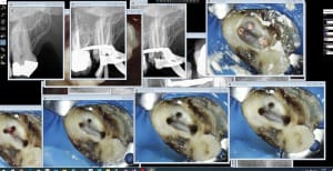 Endo 27 jrkxtt - Eugenol