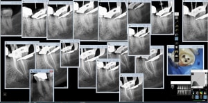 Endo 37 bfidcl - Eugenol
