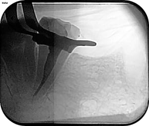 Endo 37 bis isphmz - Eugenol