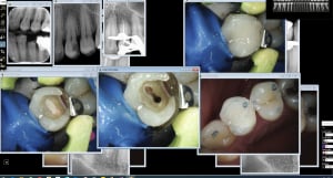 Endo sc 33 pm2n8f - Eugenol