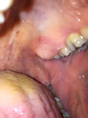 Eoiq1az6ksmogggfflzu - Eugenol