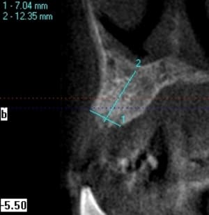 Exemple i cat 1 xjllzw - Eugenol