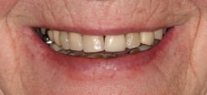 Face2 ldsatr - Eugenol