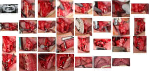 Figuesmolles xod0m4 - Eugenol