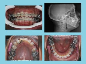 Fin 1 ubh56a - Eugenol