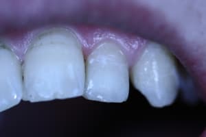 Fin l9mm7s - Eugenol