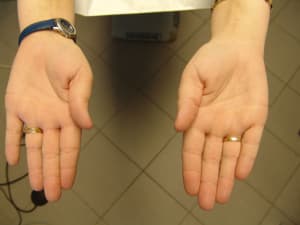 Fn4 nktxai - Eugenol