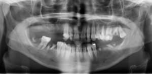 Fqkop9t3h1grilt8arcd - Eugenol