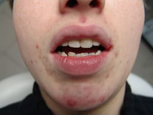 Gena h2fhxj - Eugenol