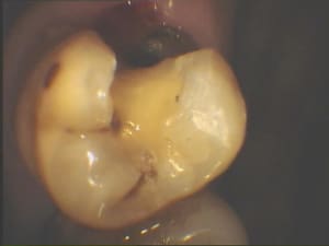Glf1 a6sbsm - Eugenol