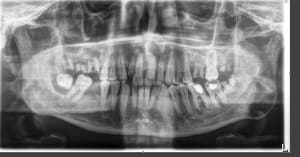 H0it8upbhaqfoe47bps4 - Eugenol