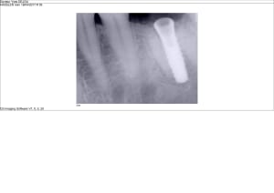 Hassller ca95hz - Eugenol