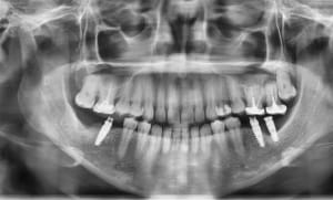 Hd7d1pm8kn5bgkkz2azyxgj035ow - Eugenol