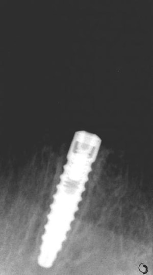 Hermo4 bdqncq - Eugenol