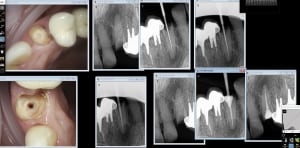 Hug 23 n5kqht - Eugenol