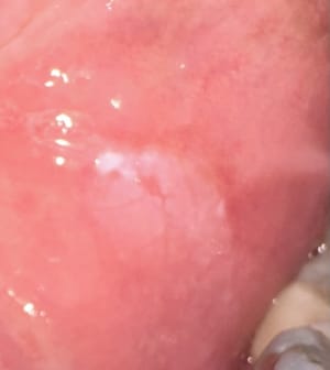 Hvyfku7qh8bd736jsmw75ixyne22 - Eugenol