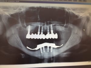 Image1 hmqteq - Eugenol