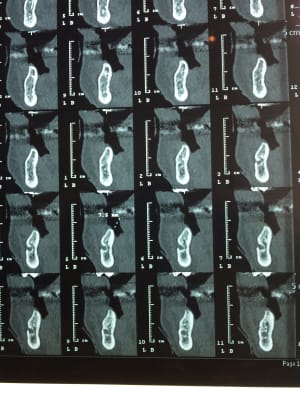 Image vmqxnk - Eugenol