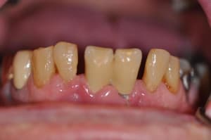 Inf3 o6uwf0 - Eugenol