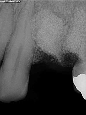 Juin2009 2 jpztho - Eugenol