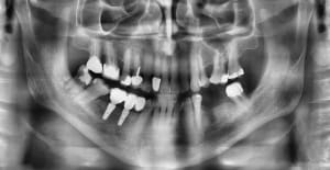 Jyyyr1rhxagdhj2iil6ylaksxx21 - Eugenol