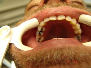 Kb2 ynpgqy - Eugenol