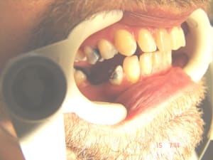 Kb3 gudyxn - Eugenol