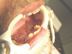 Kb4 javzws - Eugenol